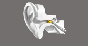 phonak lyric